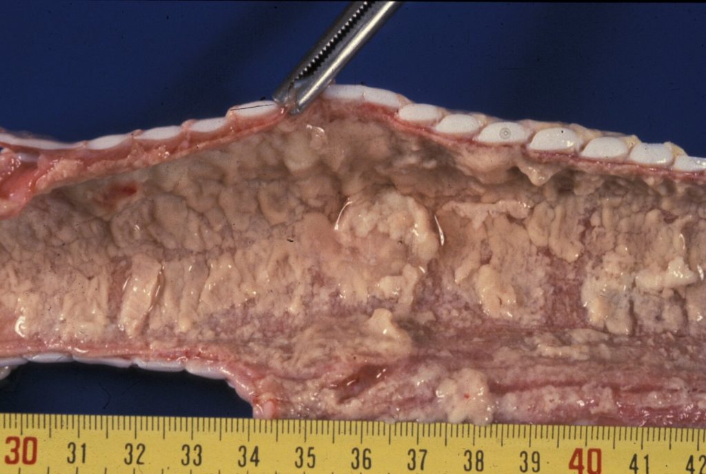 Fig. 2: Traqueítis fibrinosa, en un caso de IBR.